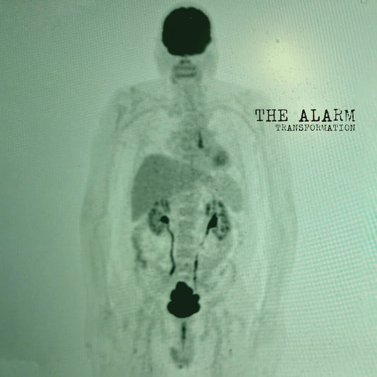 Alarm - Transformation [Colored Vinyl] (Grn) (Can)